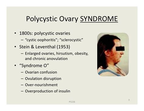 Polycystic Ovary Syndrome (PCOS)