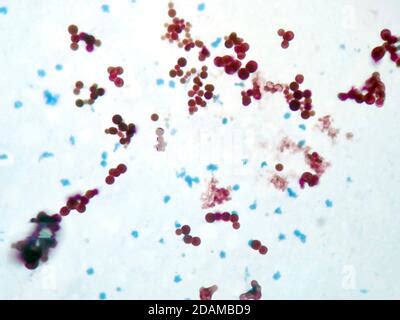 Mycobacterium marinum bacteria, light micrograph. Mycobacterium marinum ...