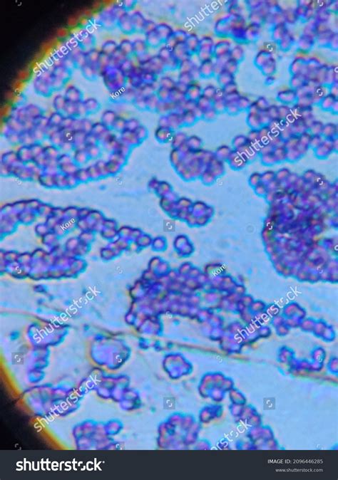 Staphylococcus Aureus Microscope