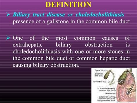 Biliary tract Disease.ppt