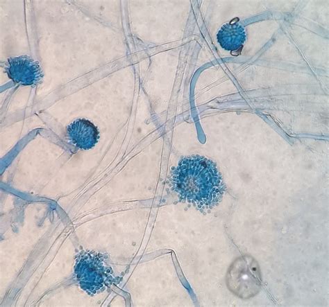 Aspergillus Flavus : Aspergillus flavus. I think this picture kind of ... - Aspergillus flavus ...