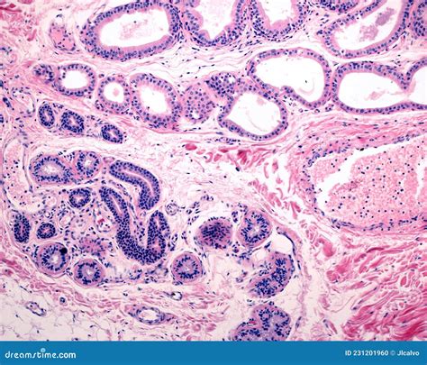 Eccrine Vs Apocrine Sweat Glands Histology