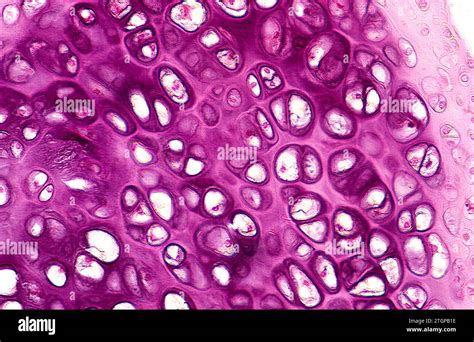 Cartilage section showing chondrocytes, lacunae and matrix ...