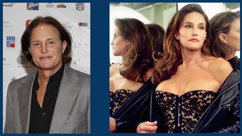 Caitlyn Jenner: Effects of Sex Change Surgery You Didn’t Know