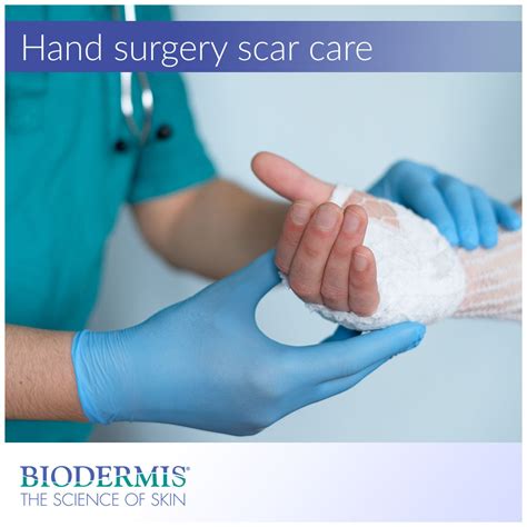 The Best Scar Treatment After Hand Surgery | Biodermis.com