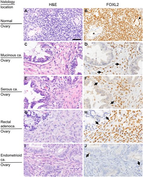 Distribution of FOXL2-positive stromal cells in the ovary. (A and B ...