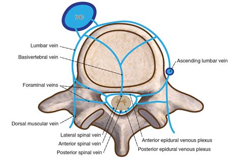 The Lumbar Neural Foramen and Transforaminal Epidural Steroid Injections: An Anatomic Review ...