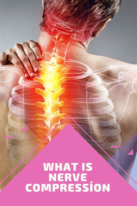 What Is Nerve Compression? What are the symptoms and how do I pass? | Nerve, Medical, I passed