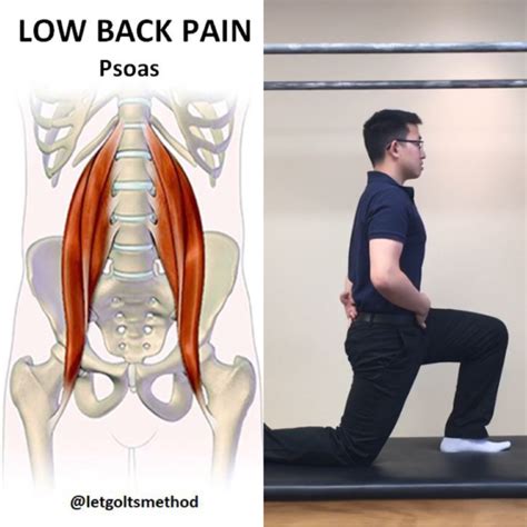 What Causes Psoas Tendonitis Iliopsoas Syndrome Stretches Exercises ...