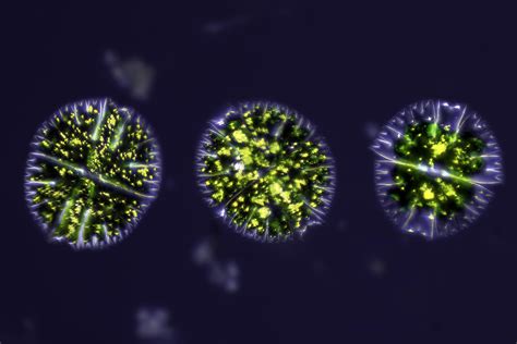 Some algae I found in some old pond water : r/Diatom