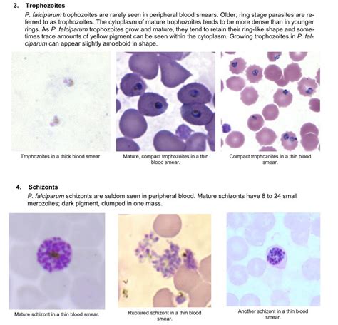 The Life Cycle of Plasmodium Falciparum | Plasmodium Falciparum