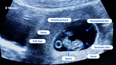 All Pregnancy Ultrasound – swastik