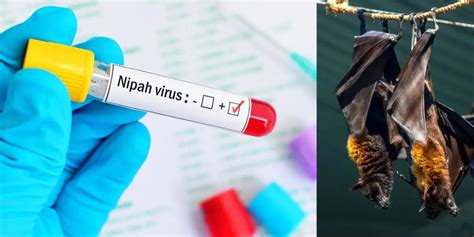 Nipah Virus Outbreak: Symptoms, Treatment, and Prevention