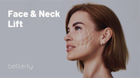 Face & Neck Lift – Betterly