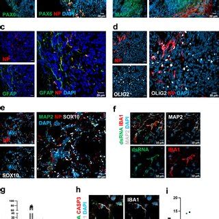 SARS-CoV-2 infection of immunocompetent brain organoids Brain organoids... | Download Scientific ...