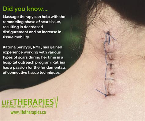 Massage Therapy Assists with Scar Remodeling • Life Therapies - Health and Wellness Centre Ottawa