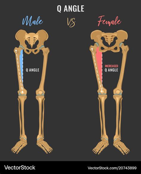 Ustlat postel Deset Velbloud male bone structure Společenský v ...