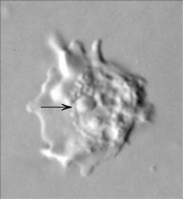 Skeptic Wonder: Sunday Protist - Perkinsela: Life as an organelle