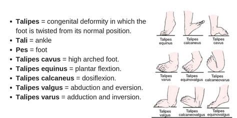 Congenital Talipes Equinovarus (Clubfoot) Nursing Management | Nurse ...