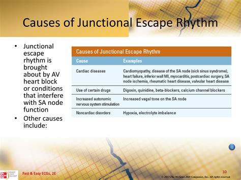 PPT - Junctional Dysrhythmias PowerPoint Presentation, free download ...