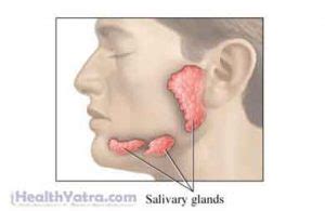 Parotitis Definition, Causes, Symptoms, Complications and Treatment in ...