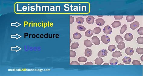 Leishman stain: Principle, Procedure, use | Stain, Principles, Conical ...