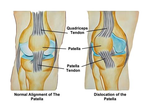 Patella Anatomy - Anatomical Charts & Posters