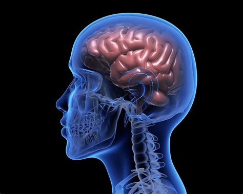 Hemorrhagic Stroke | American Stroke Association