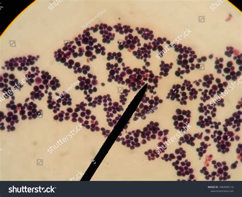 Candida Albicans Gram Stain