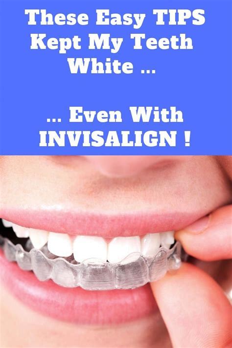 How To Wash Invisalign Retainer - Just For Guide