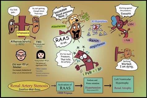 Renal artery stenosis and Secondary hypertension - Creative Med Doses