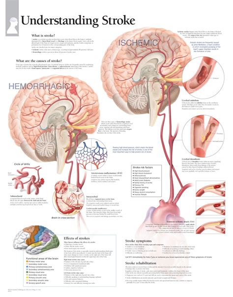 Understanding Stroke Anatomy Poster - Clinical Charts and Supplies