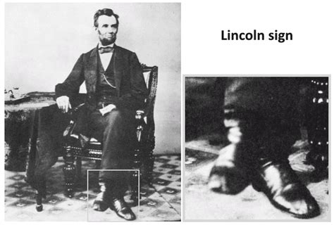 Lincoln sign • LITFL • Medical Eponym Library