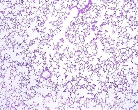 Lung Parenchyma Photograph by Jose Calvo/science Photo Library - Pixels