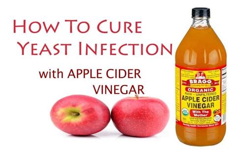 How To Use Apple Cider Vinegar For Yeast Infection Cure?