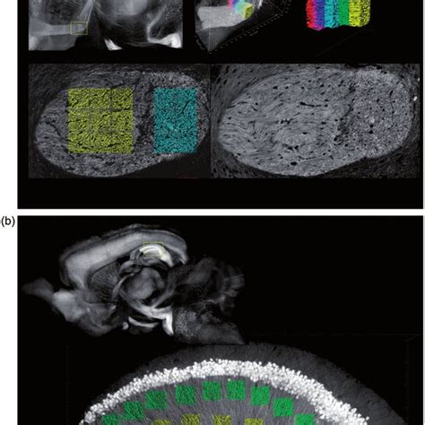 Regions of interest in the histological specimen. (a) Anterior... | Download Scientific Diagram