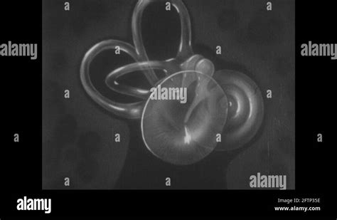 Ear drum diagram Stock Videos & Footage - HD and 4K Video Clips - Alamy