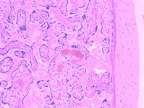 Index of /histology/female_reproductive_system_lab/images