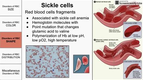 Red Blood Cell Morphological Abnormalities - YouTube