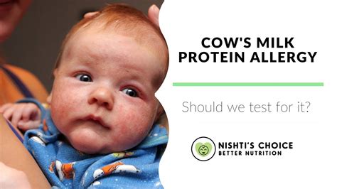 COW'S MILK PROTEIN ALLERGY - Should we test for it? - YouTube