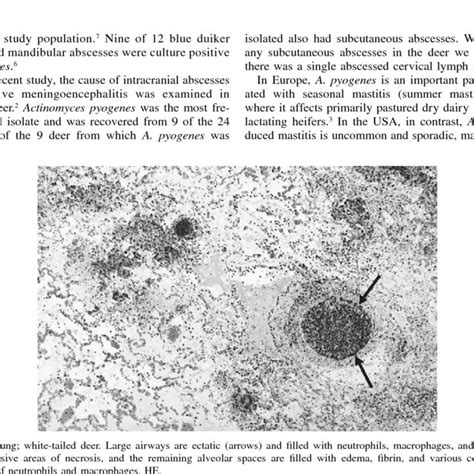 Gram-positive staining of an Actinomyces colony. | Download Scientific ...