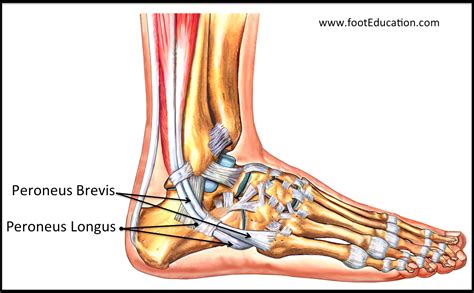 Acute Peroneal Tendon Subluxation - FootEducation