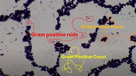 Gram Positive Under Microscope