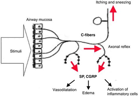 Physiology and Pathophysiology of Sneezing and Itching: Mechanisms of the Symptoms | Ento Key