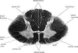 Identify the location of the dorsal horn in the spinal cord - brainly.com