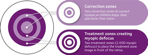 MiSight® 1 day | CooperVision Contact Lenses | CooperVision UK