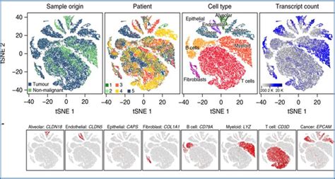 Single-cell RNA-Seq reveals 52 different types of lung tumor cells | RNA-Seq Blog