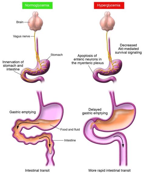 Gastrointestinal motility; Intestinal Motility