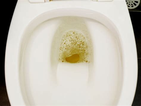 Bubbles in the Urine: Normal or Not? | New Health Advisor