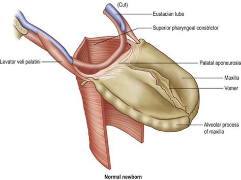 Velopharyngeal dysfunction | Plastic Surgery Key